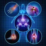 Artritis & Rheumatoid Artritis