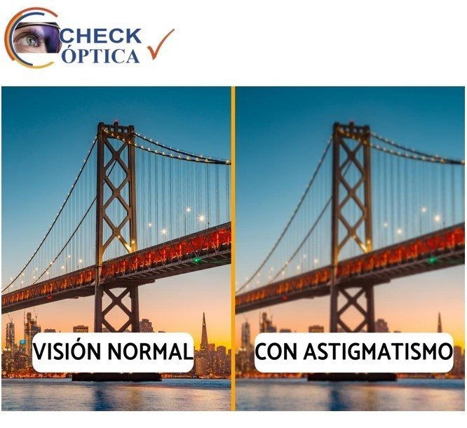 Astigmatismo