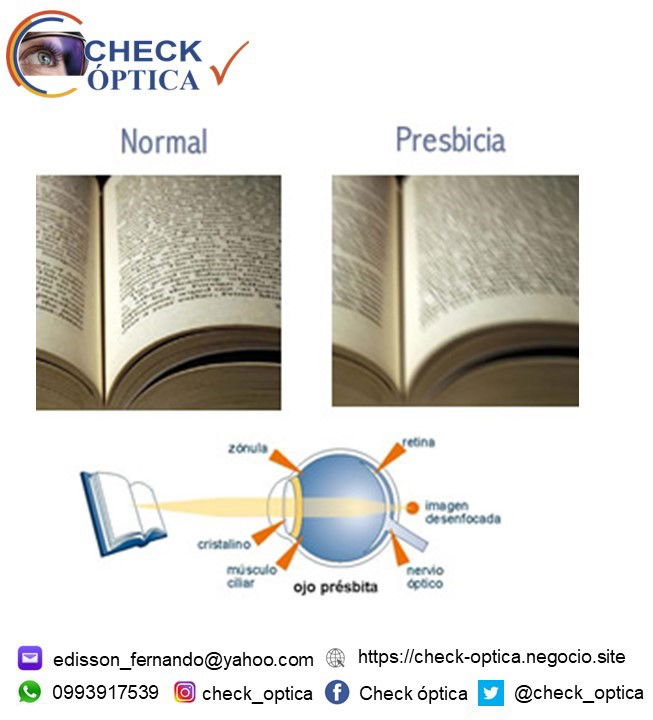 Presbicia