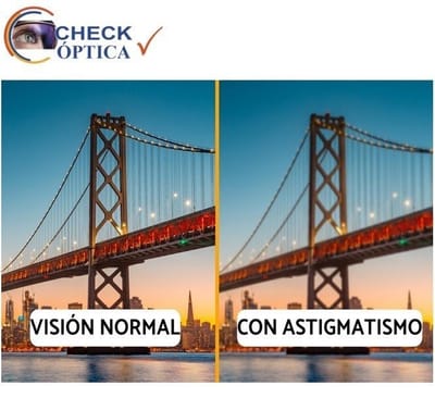 Astigmatismo