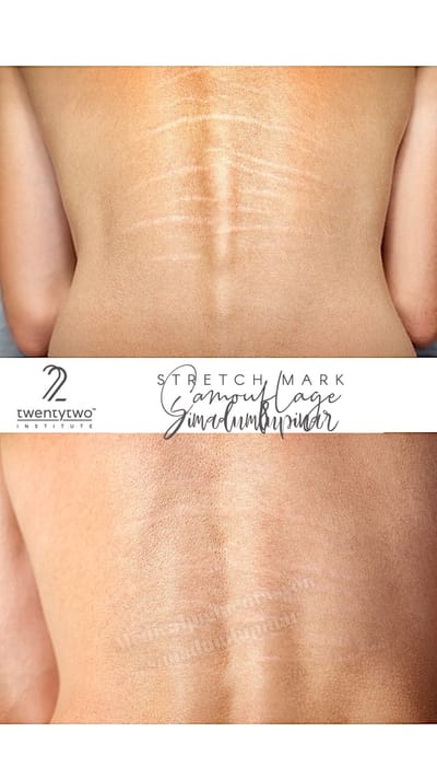 Çatlak Nasıl Geçer ? HOW DOES THE CRACK PASS?   image