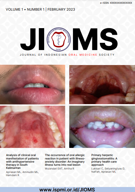 Journal of Indonesian Oral Medicine Society (JIOMS)