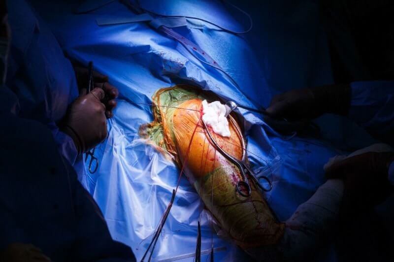 מציאות מדומה - סיפורו של אלי