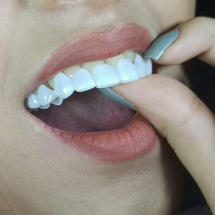 ابتسامة هوليود المتحركة سناب أون سمايل