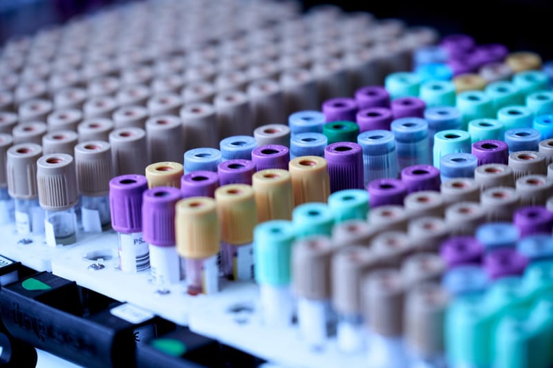 各項化驗檢測Various Laboratory Tests ,Medical Diagonostic Service