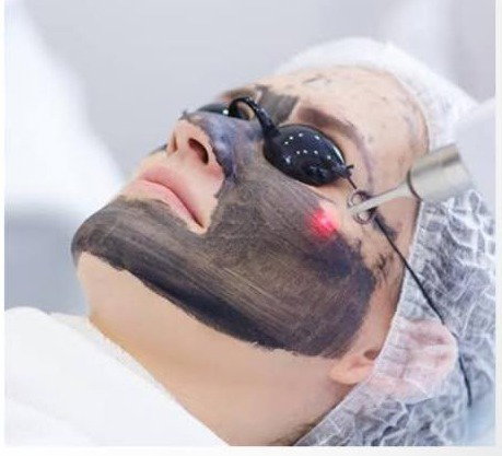 LASER TREATMENT