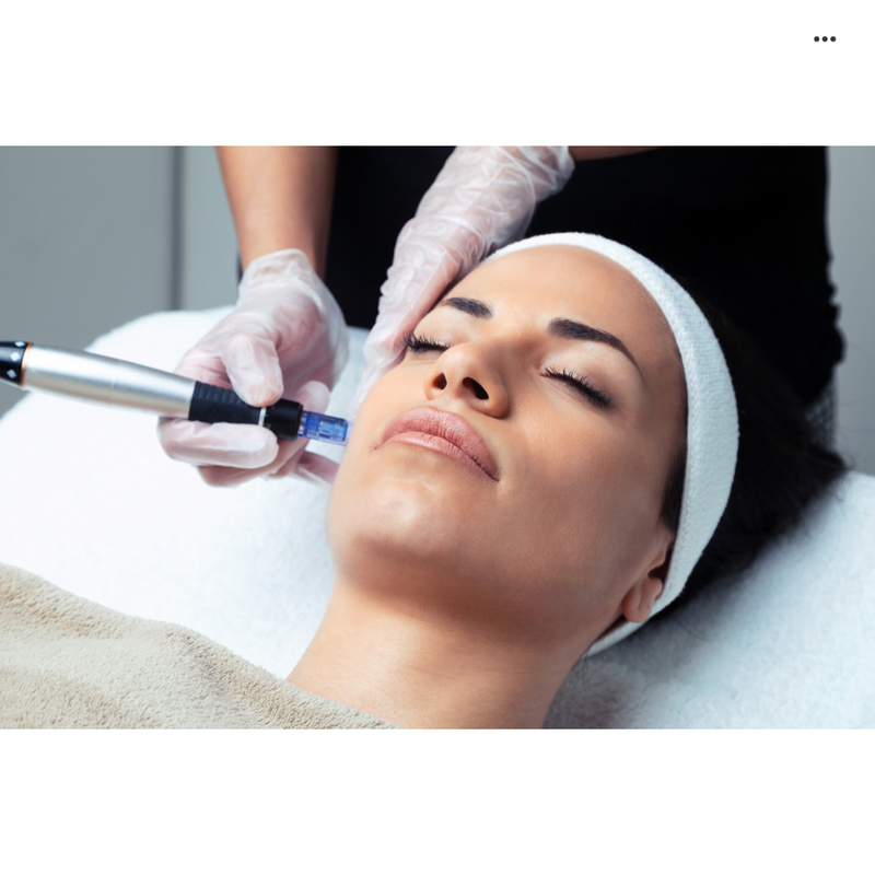 MICRONEEDLING