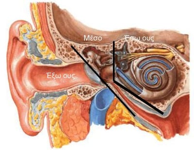 Ωτίτιδες-Δεν είναι όλες ίδιες!