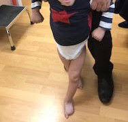 Fetal counseling - hard and doubtful