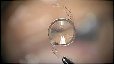 WHICH LENS IS BEST SUITABLE AFTER CATARACT SURGERY?