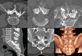 Tratamiento del dolor