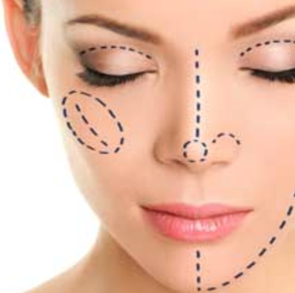 DERMAL FILLERS