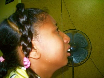 تعديل جراحي لعظام الوجه والفكين