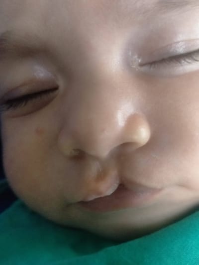 شفه ارنبيه.