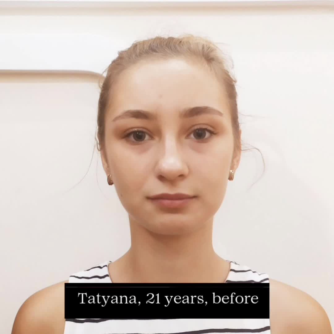 Фотозвіт у дінаміці