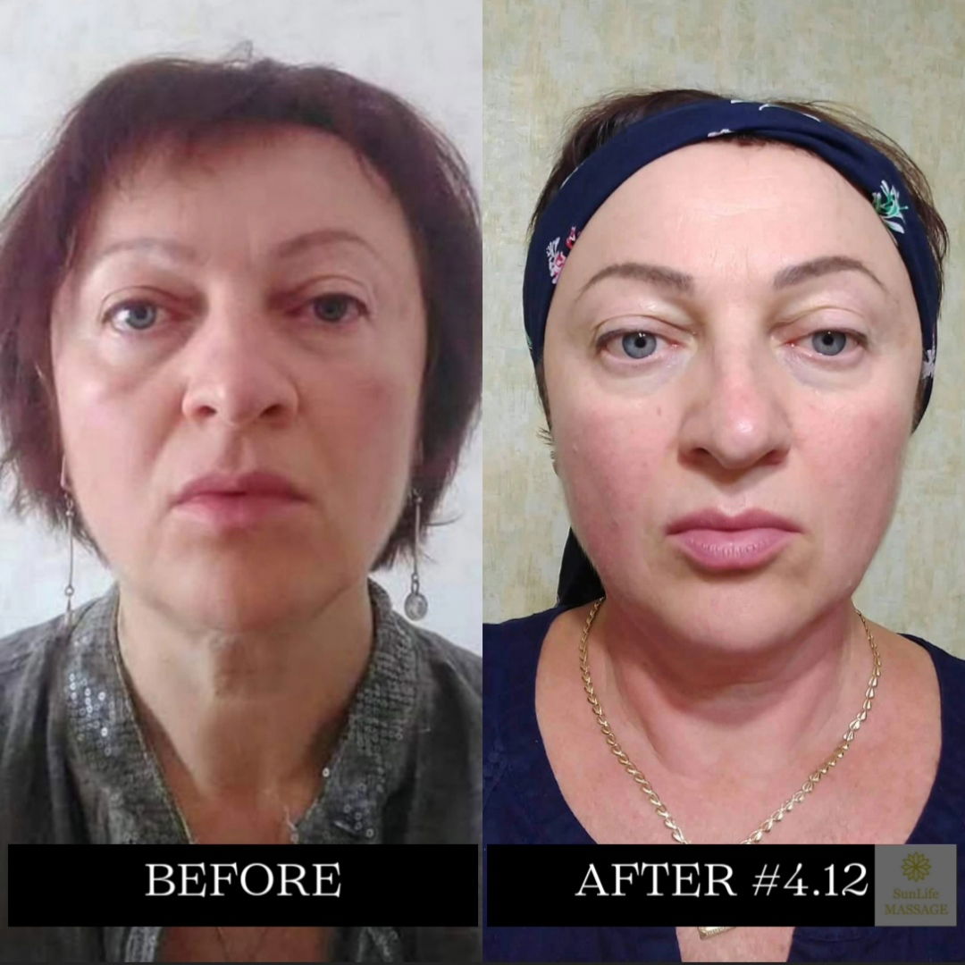 Photo Reports of the Sequence