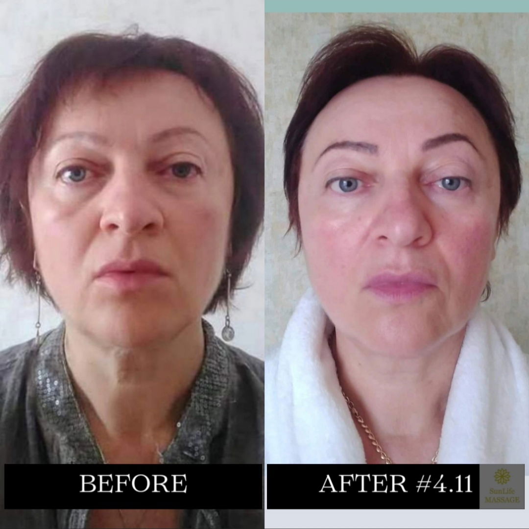 Photo Reports of the Sequence