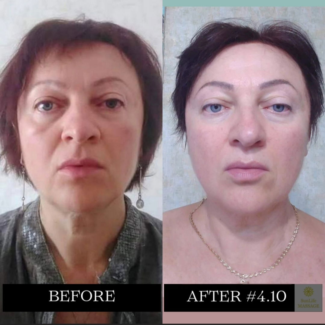 Photo Reports of the Sequence