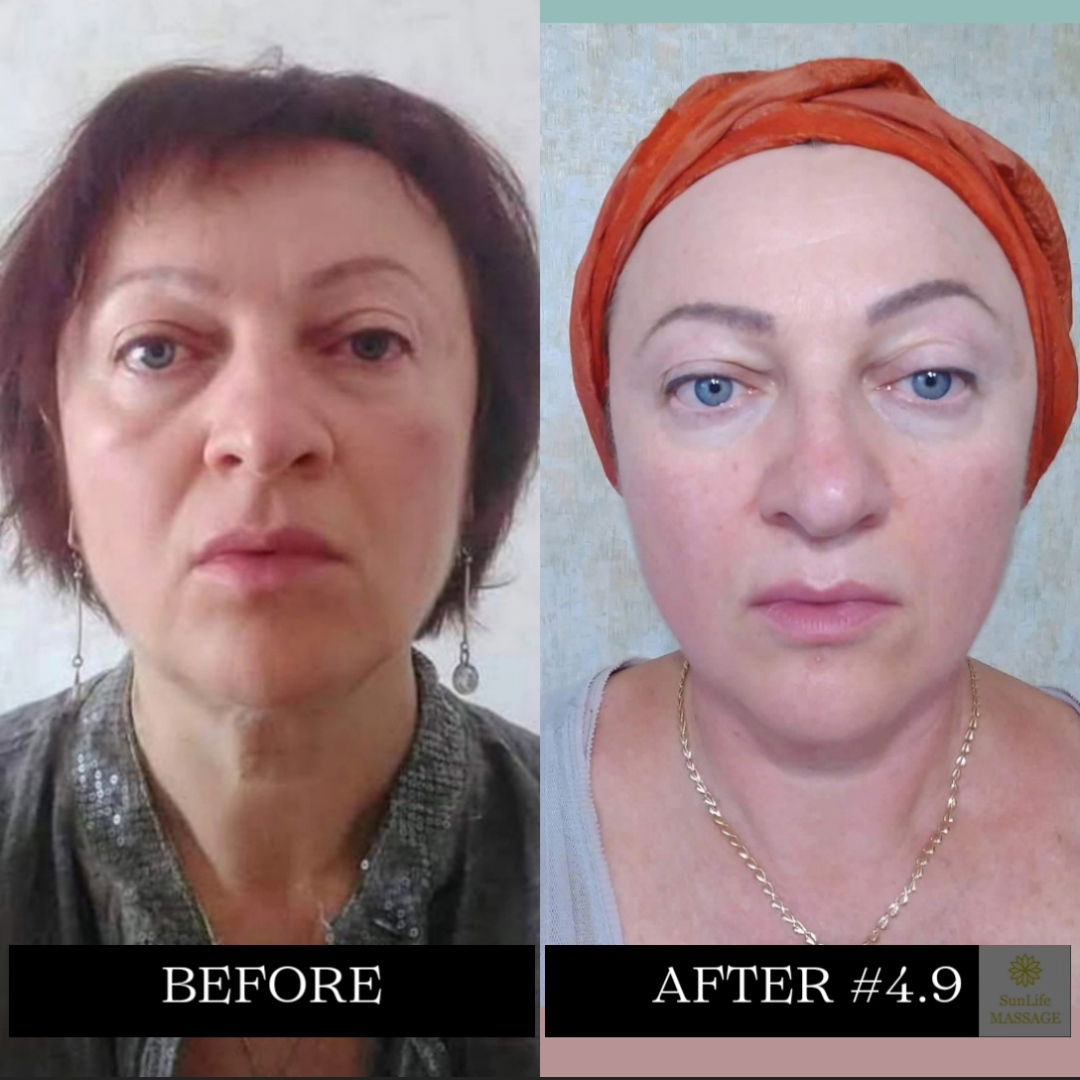 Photo Reports of the Sequence