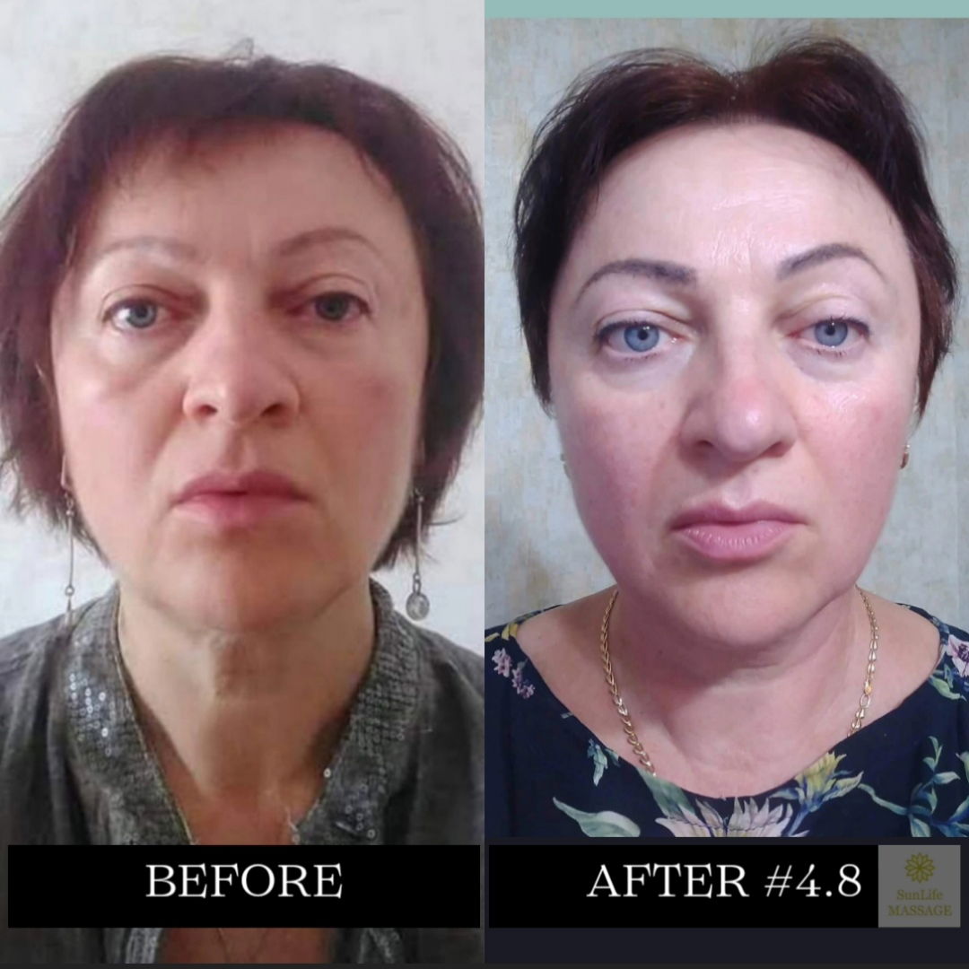 Photo Reports of the Sequence