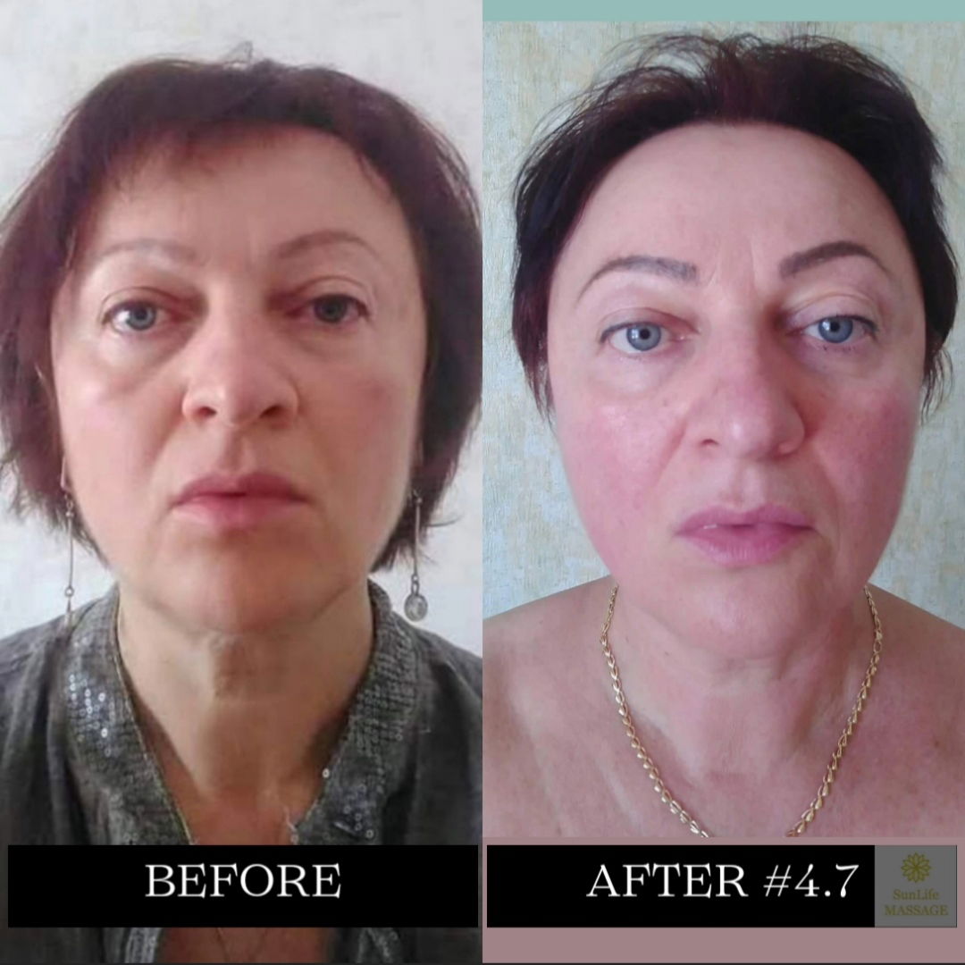 Photo Reports of the Sequence