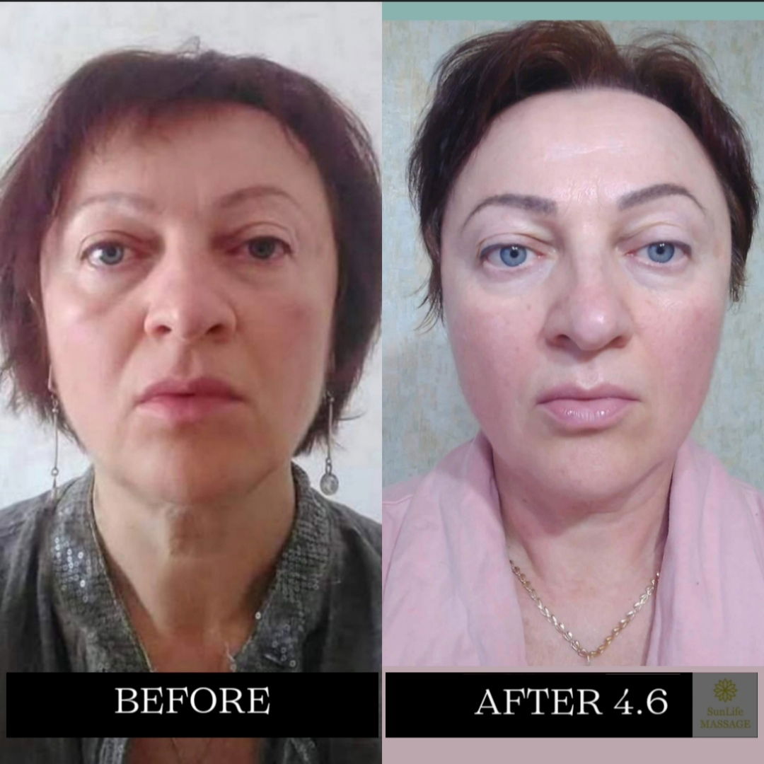 Photo Reports of the Sequence