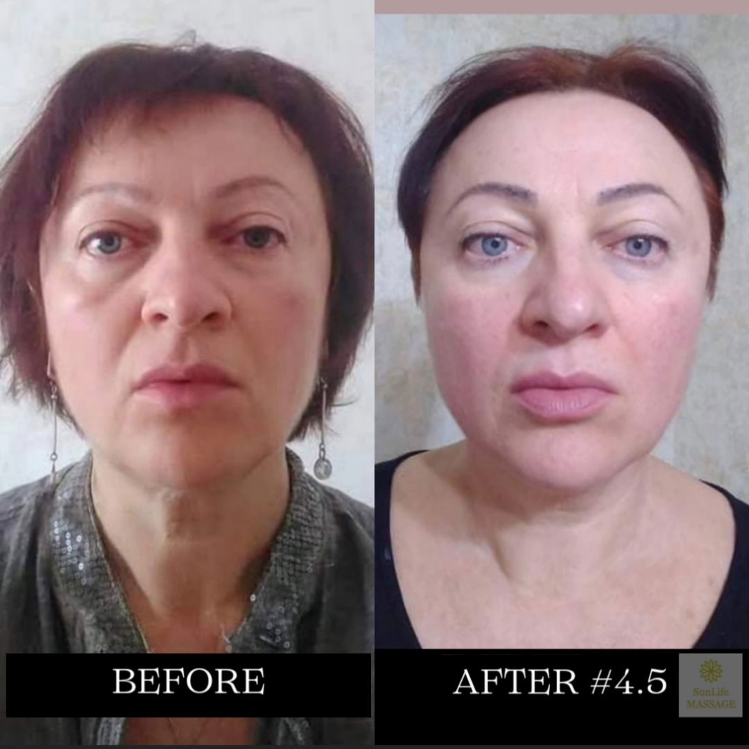 Photo Reports of the Sequence