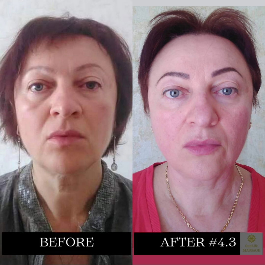 Photo Reports of the Sequence