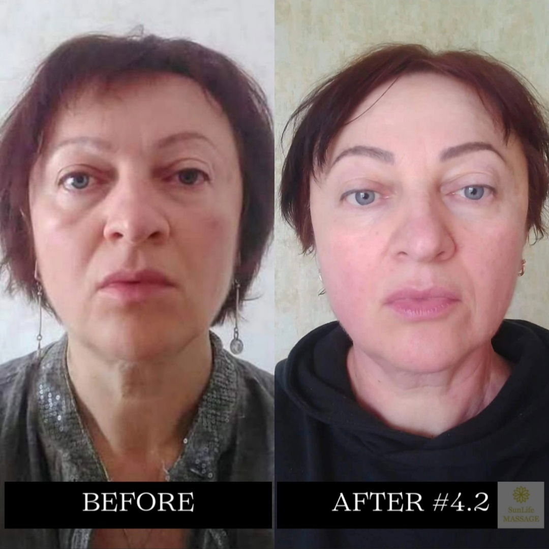 Photo Reports of the Sequence