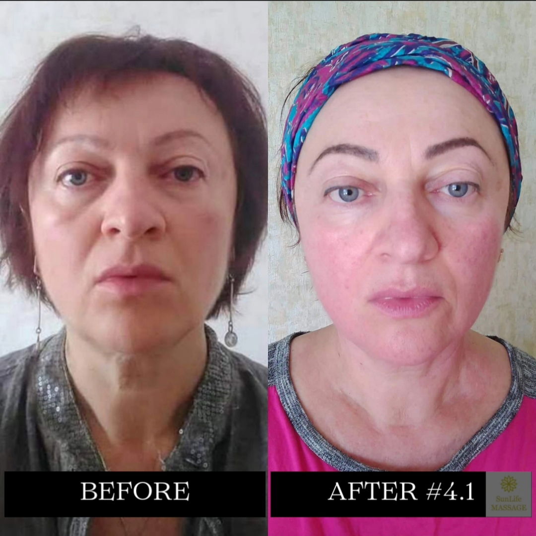 Photo Reports of the Sequence