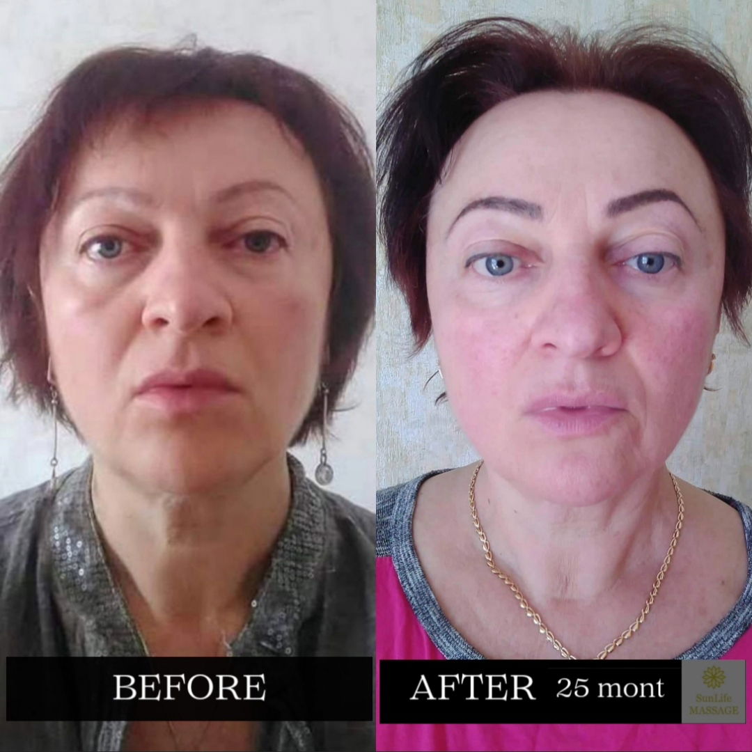 Photo Reports of the Sequence