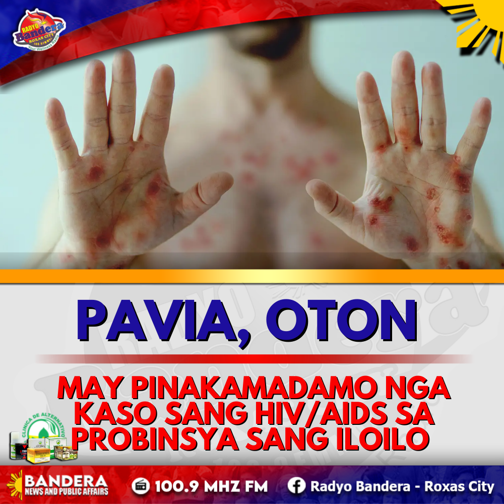 REGIONAL | PAVIA, OTON MAY PINAKAMADAMO NGA KASO SANG HIV/AIDS SA PROBINSYA SANG ILOILO