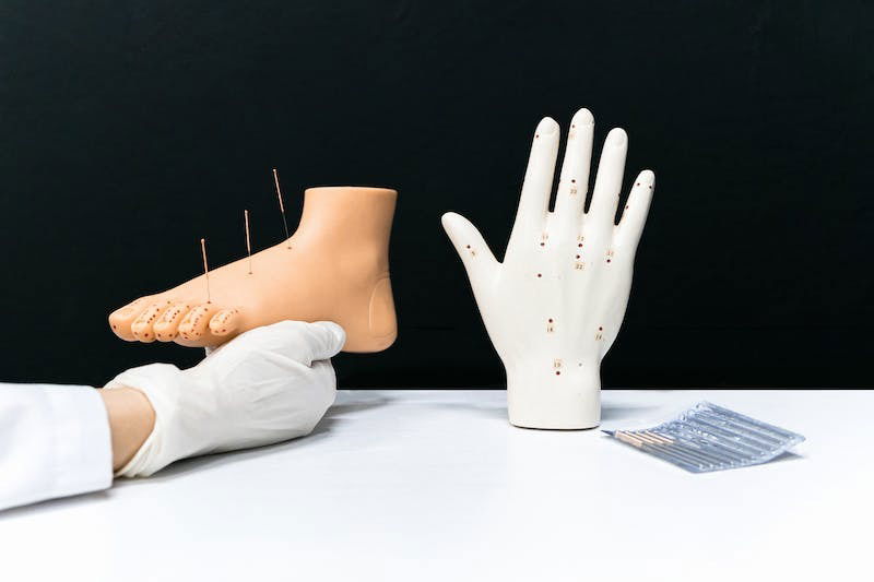 Acupunctura