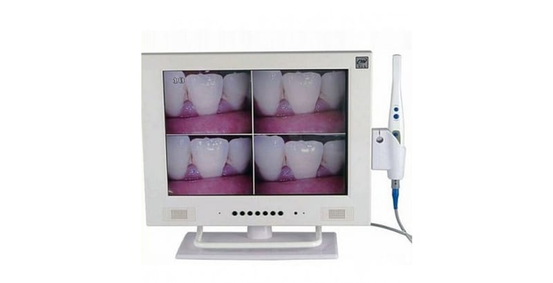 Cámara Intraoral