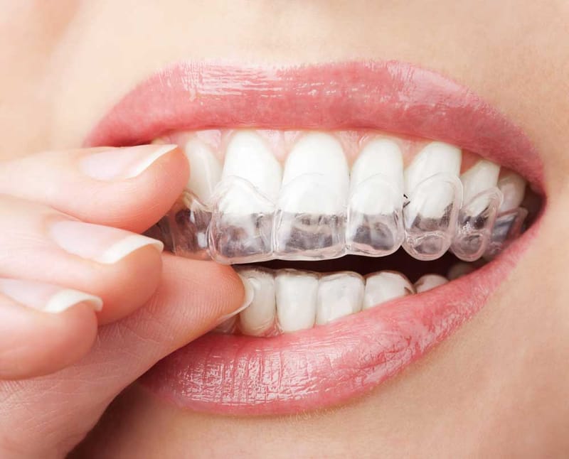What Is The Role Of Osseointegration In Implant-Supported Dentures?