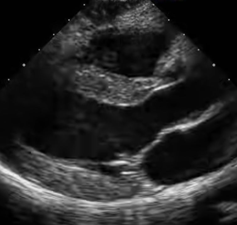 Echocardiography