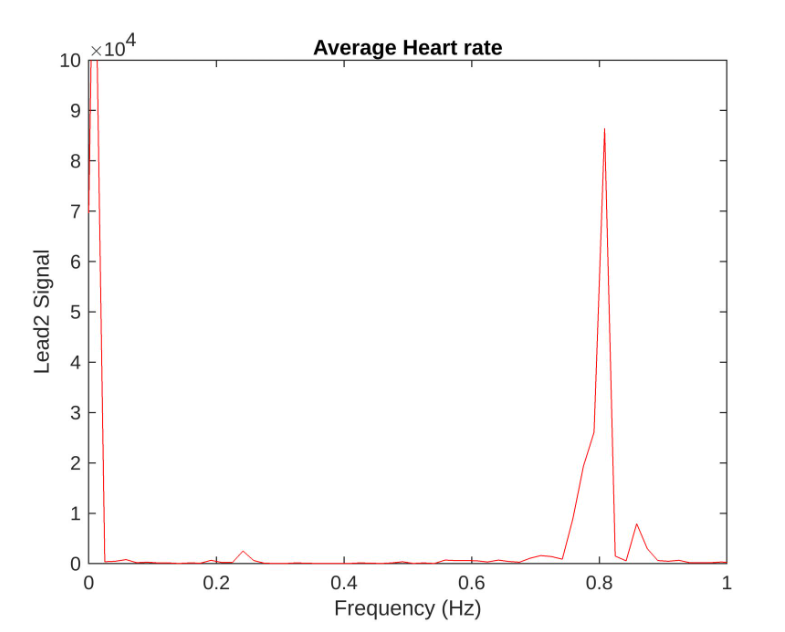 Matlab 1D Signal Processing