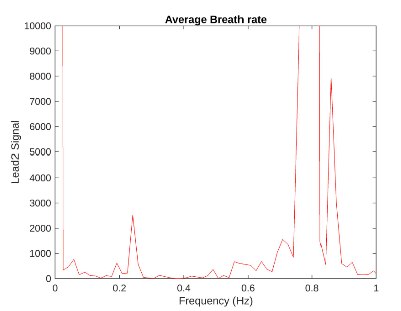 Matlab 1D Signal Processing