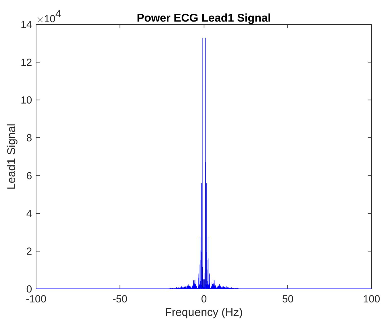 Matlab 1D Signal Processing
