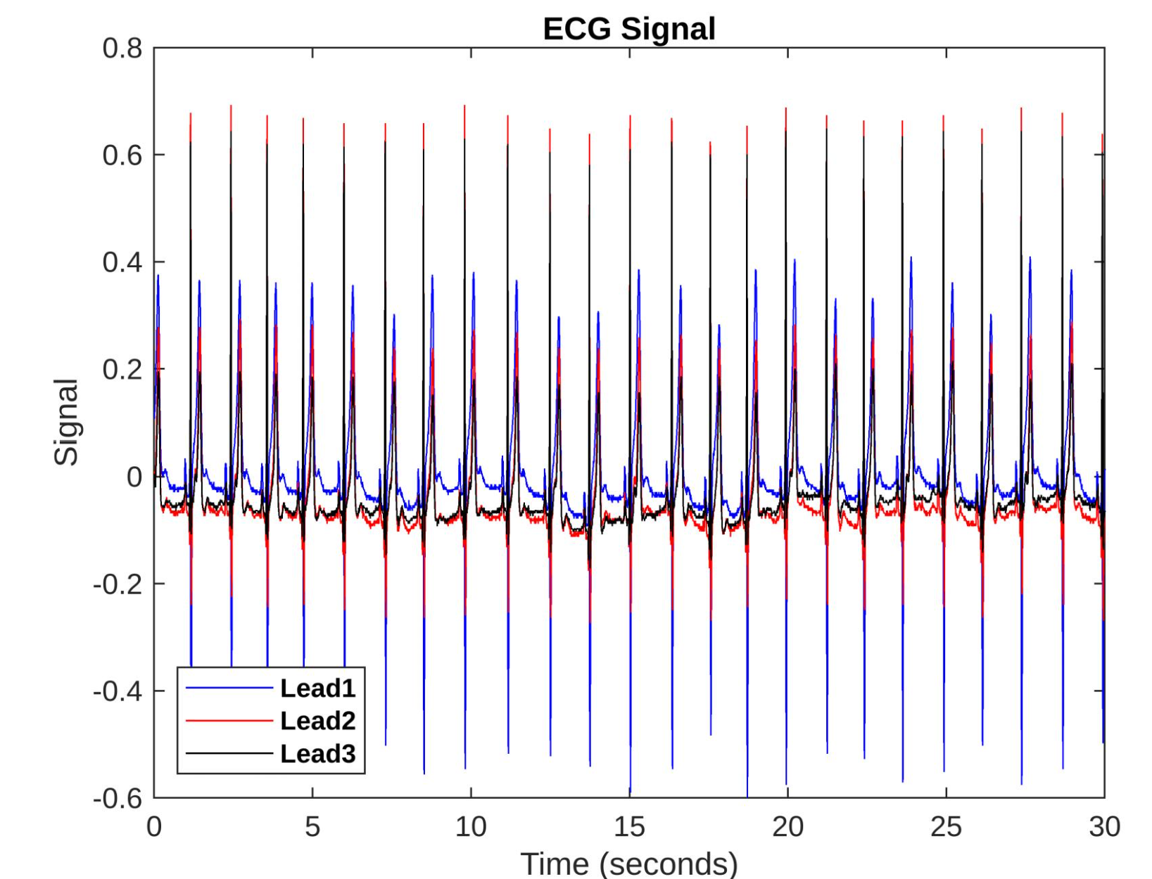 Matlab 1D Signal Processing