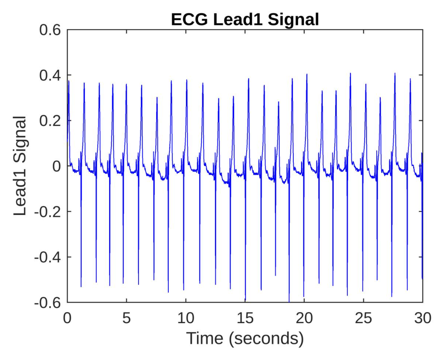 Matlab 1D Signal Processing