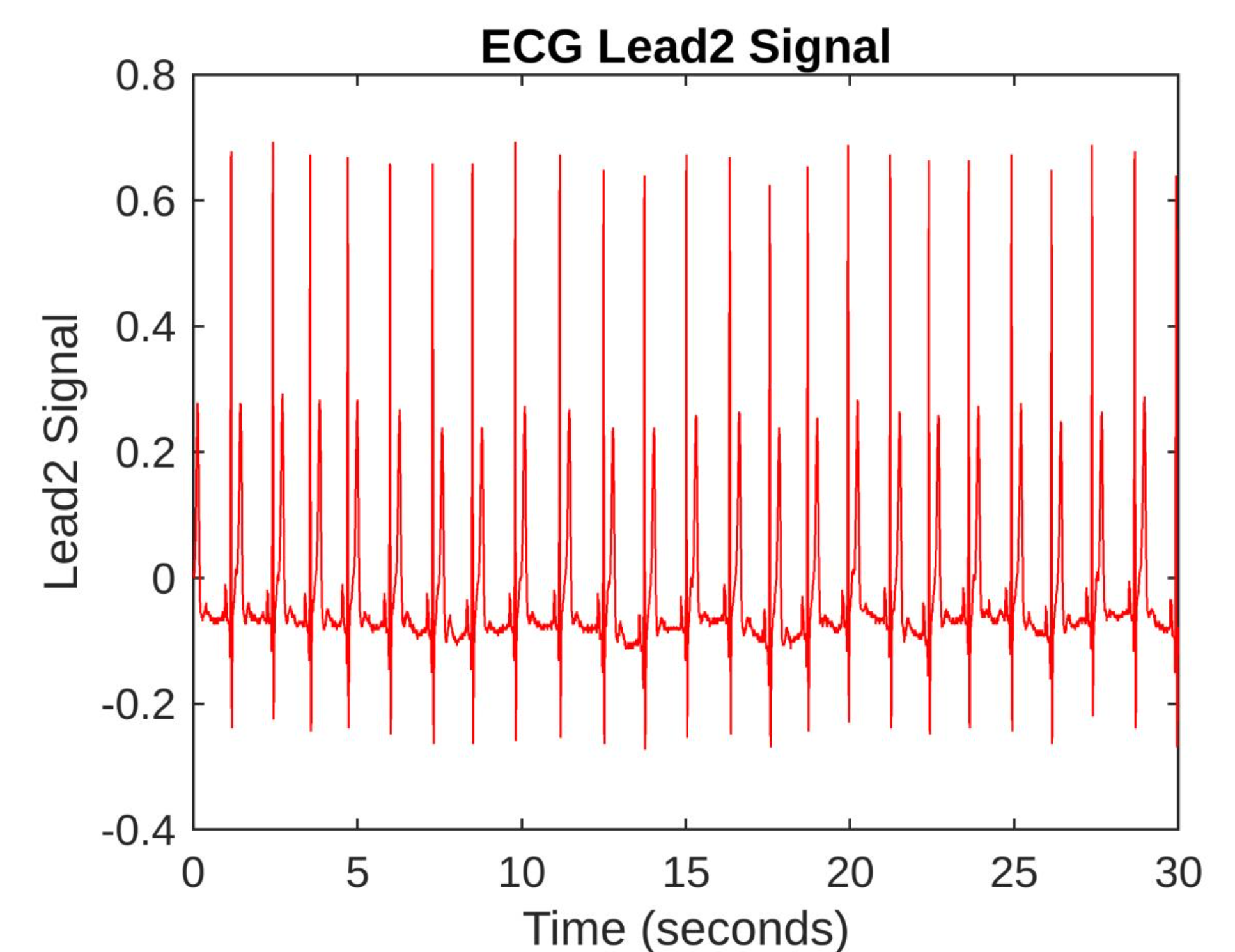 Matlab 1D Signal Processing