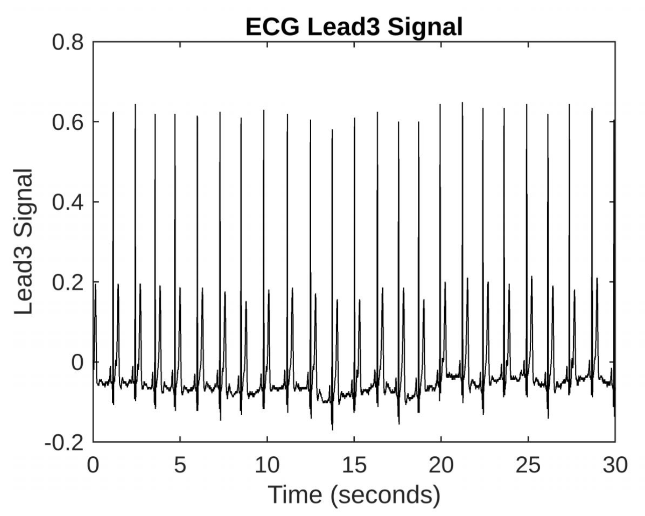 Matlab 1D Signal Processing