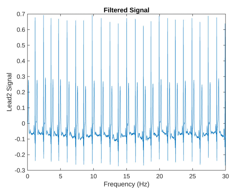 Matlab 1D Signal Processing