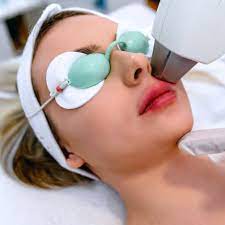 LASER TREATMENT