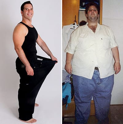 weight loss transformations : The Transformative Journey of Weight Loss