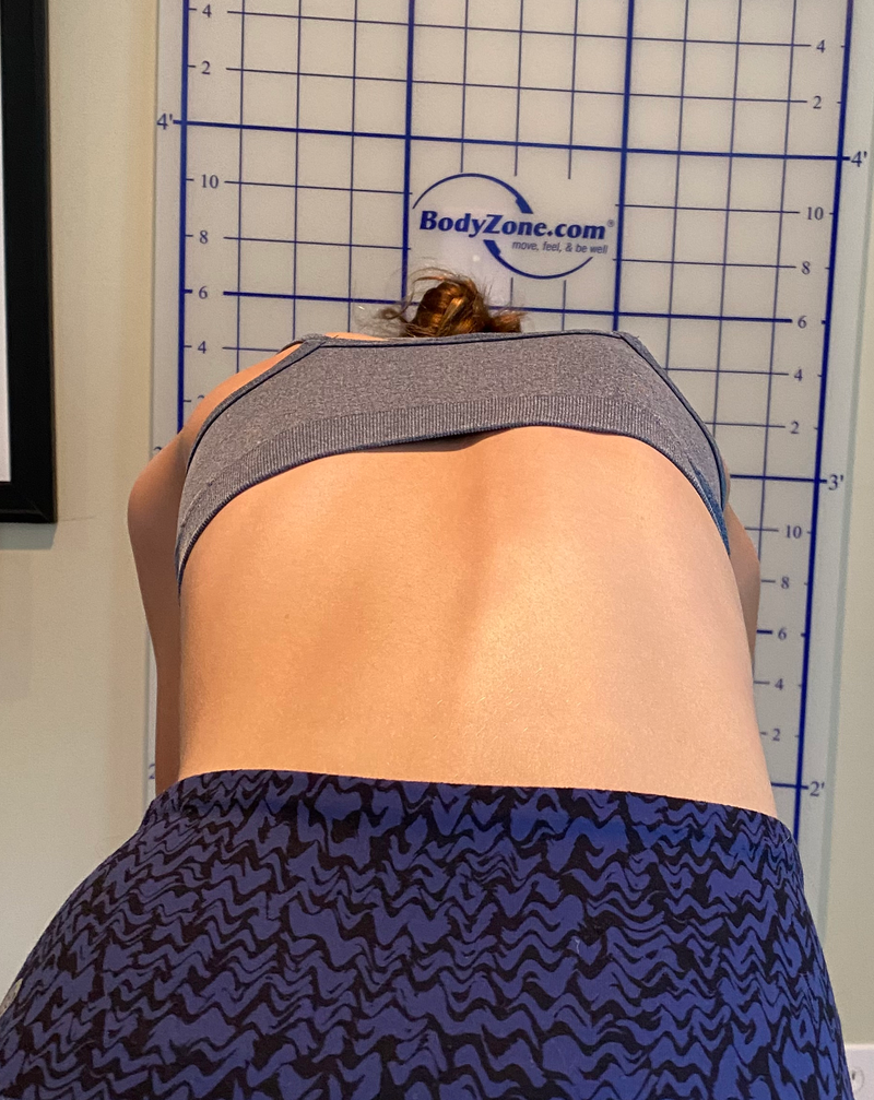 Discover the Roadmap to Relief with Non-invasive Scoliosis Treatments