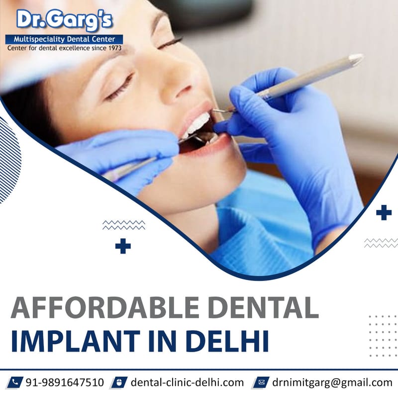 Dental Implants: A game changer for missing teeth - dentalclinicdelhi