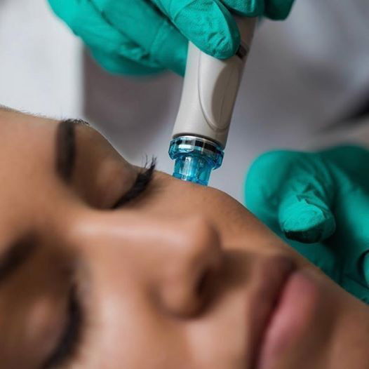 МЕЗО +ББГЛОВ 2 модели